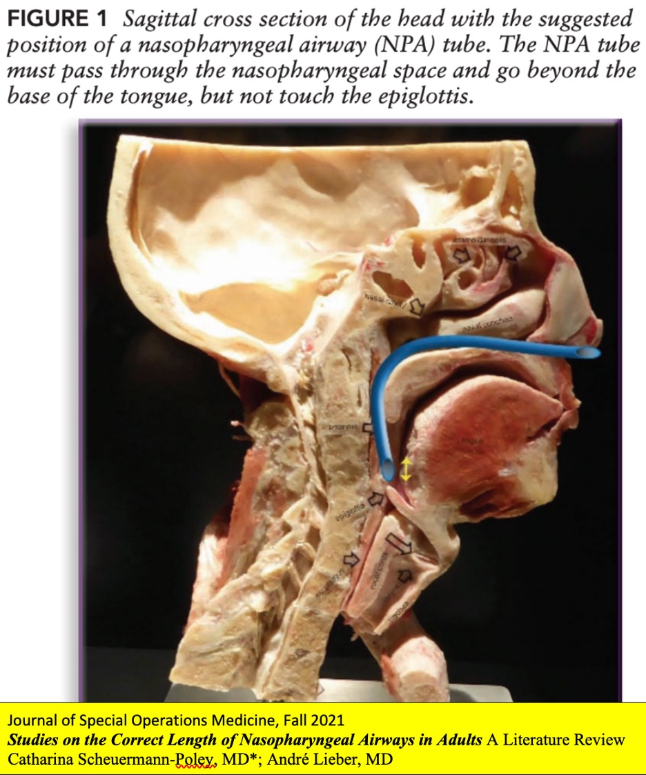 NPA Rundown | STOP THE BLEED® - American College of Surgeons